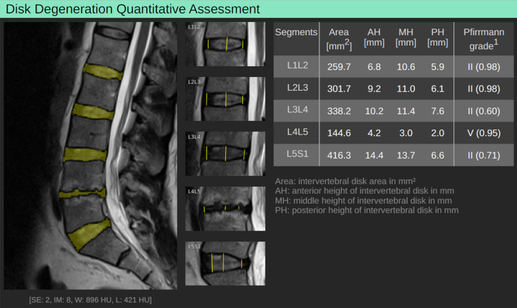 261025_Disk Generation Assessment
