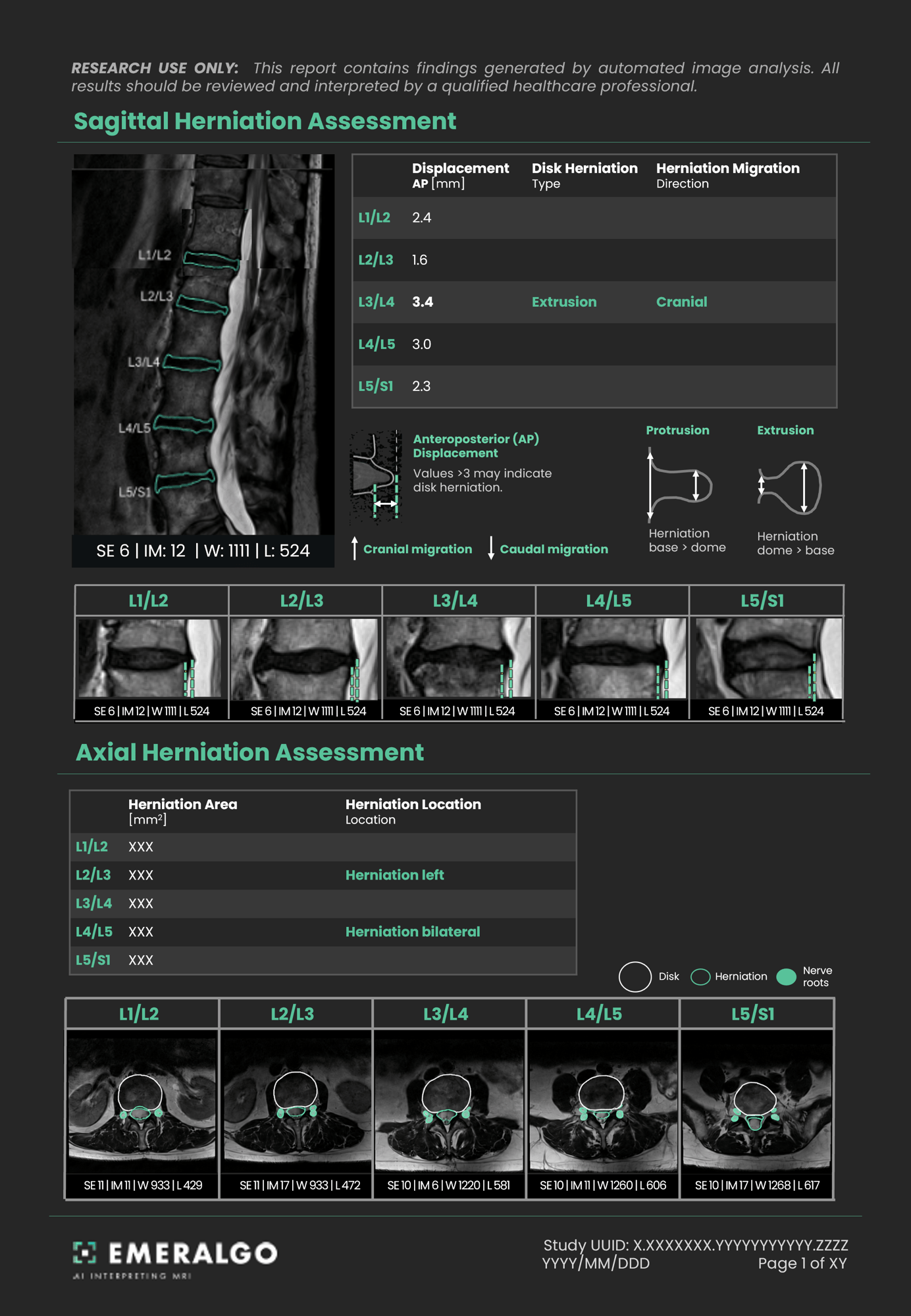 Herniation_page