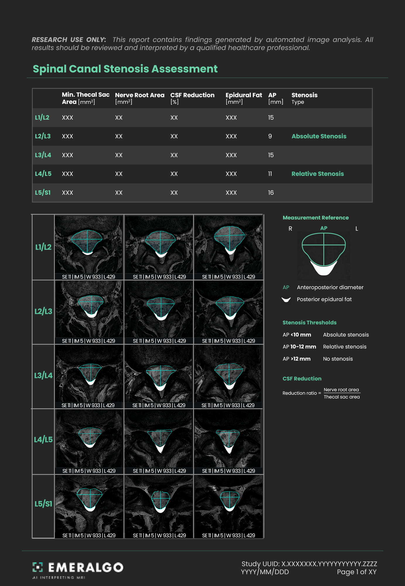spinal canal_page