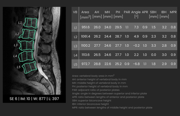 Vertebral body measurements